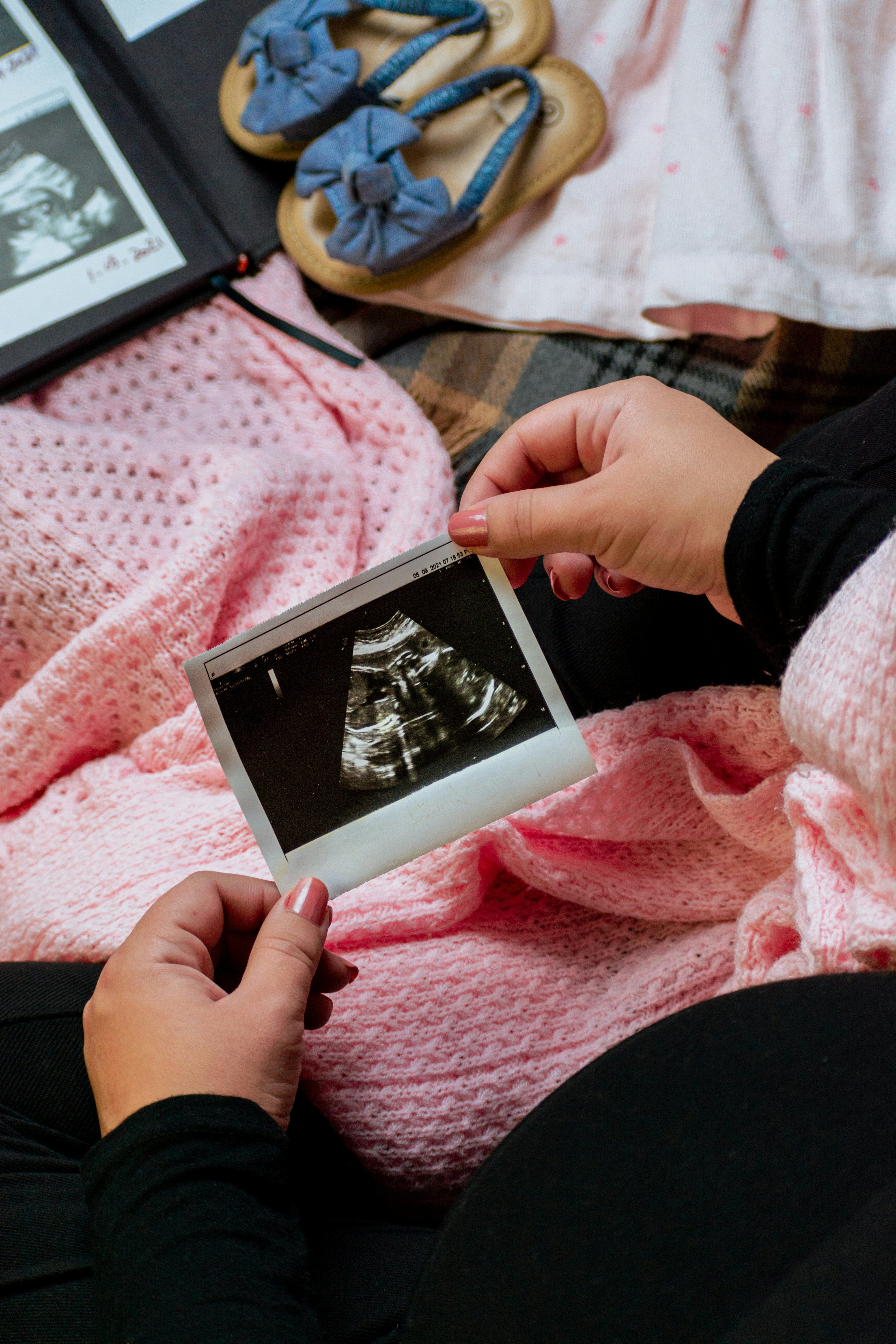 The Third pregnancy