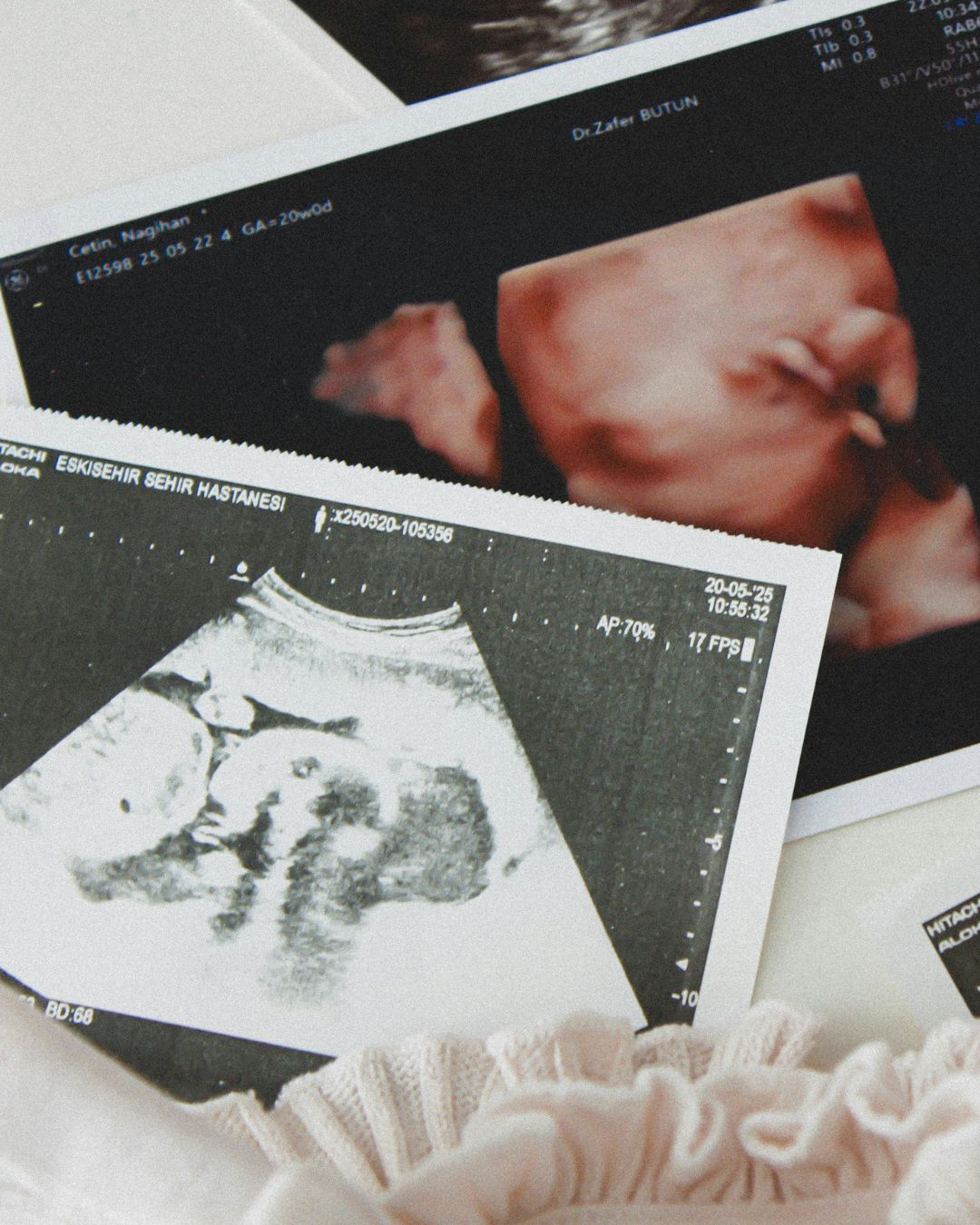 The Fourth Pregnancy